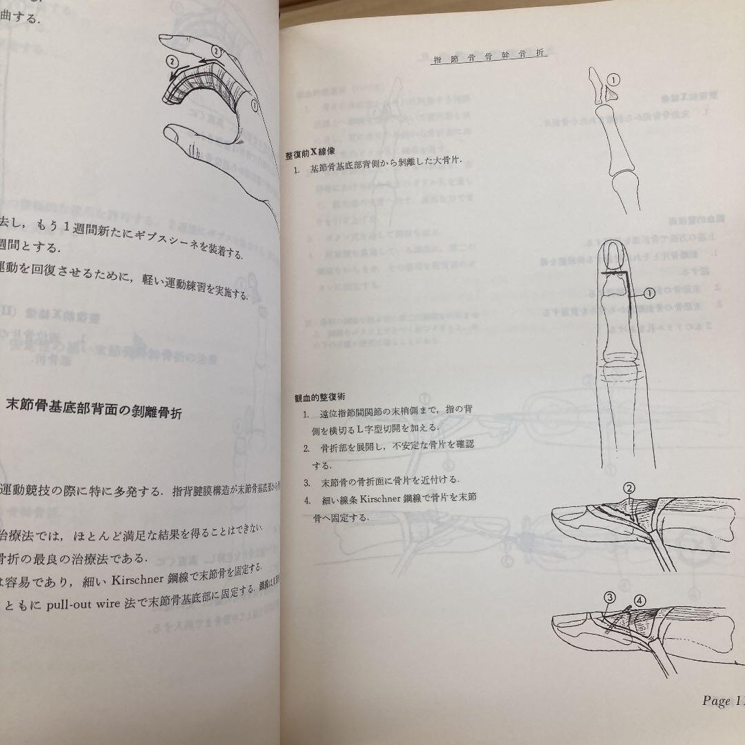 高品質100%新品 入手困難 セット デパルマ 著 ; 阿部光俊 v70XF-m47899488448 図説 骨折 脱臼の管理Ⅰ Ⅱ 送料無料限定SALE