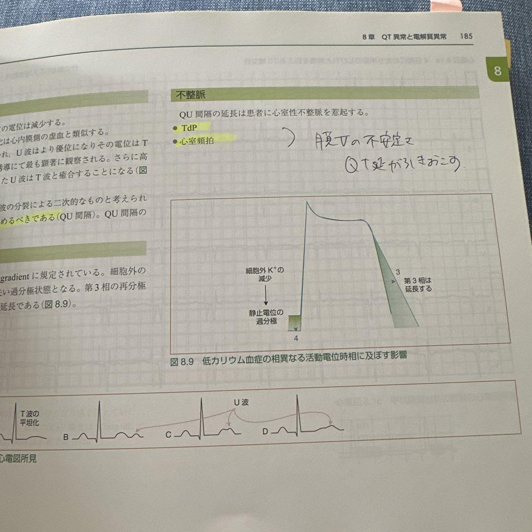 ER心電図の超速診断 カラー 救急現場で初心者から役立つ