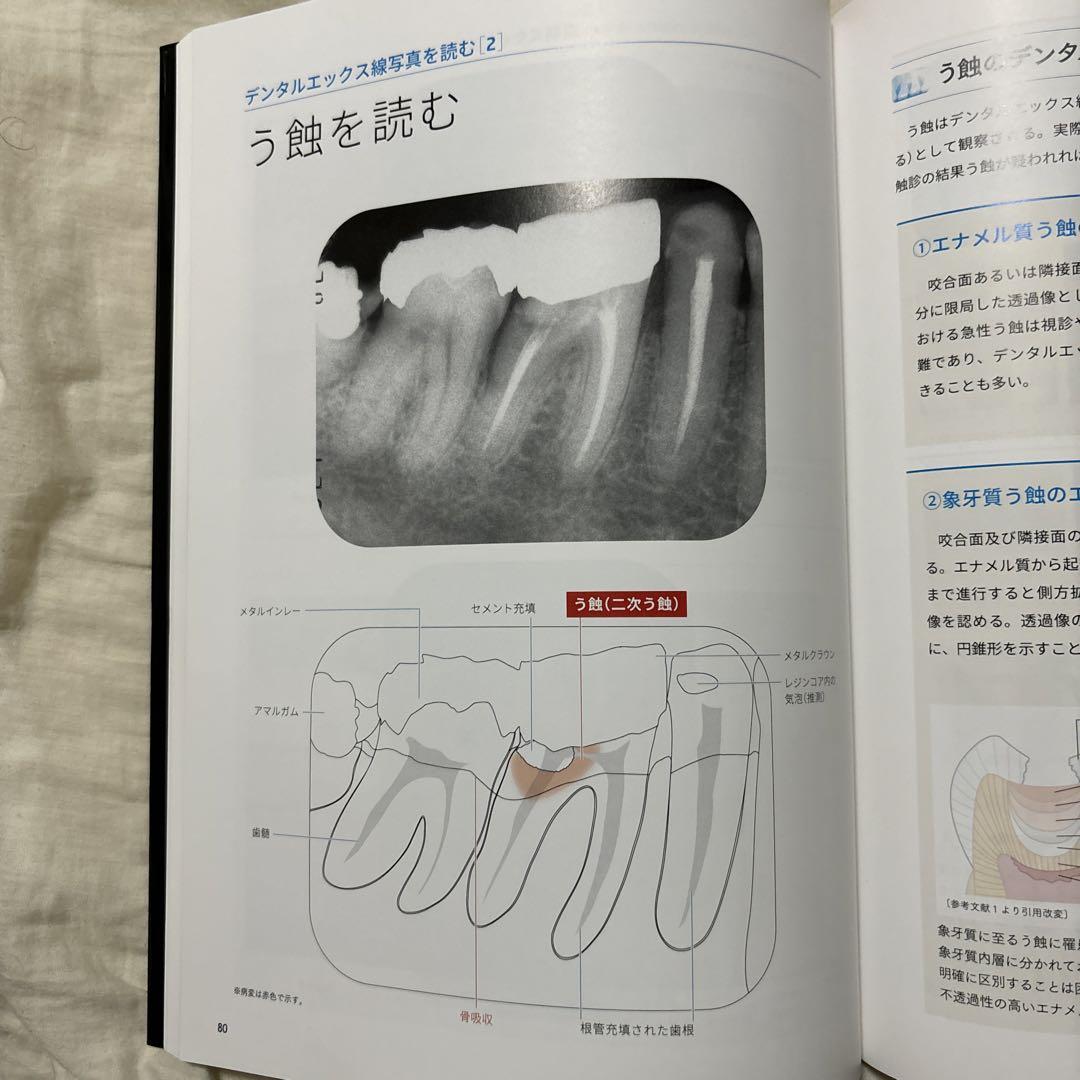 臨床に活かす!デンタルエックス線写真 : 撮る・読む・診るを