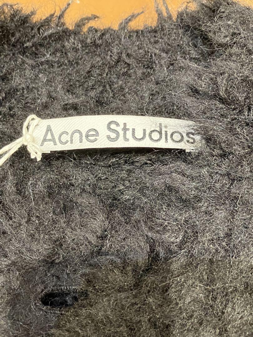 Acne