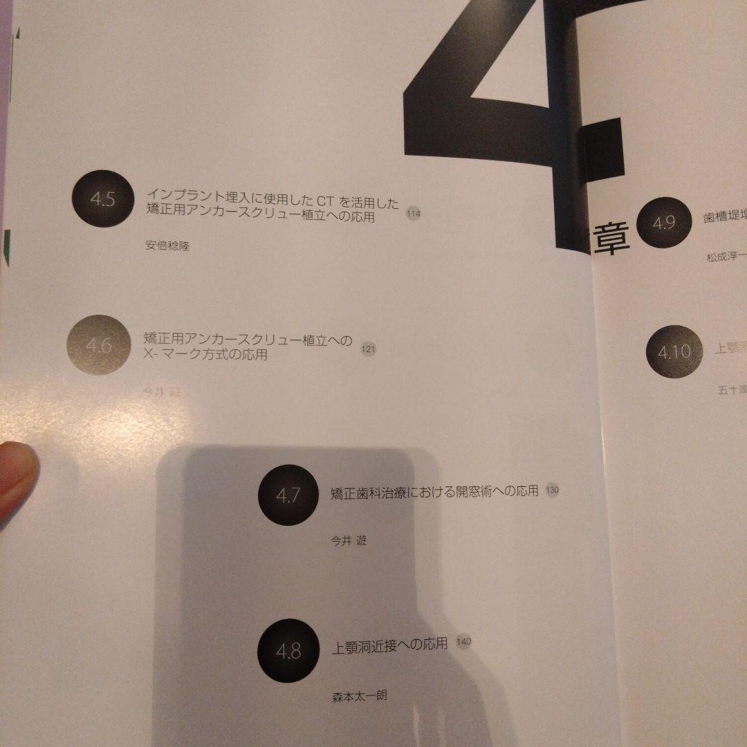 オーラル・インプラント・リハビリテーション・シリーズ Vol.4 インプラント…