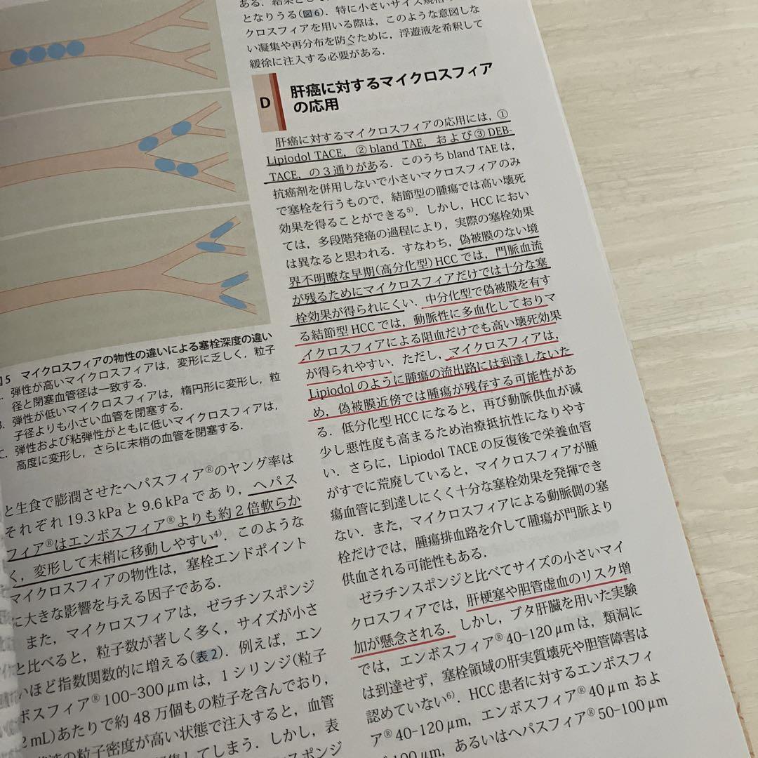 肝動脈化学塞栓療法(TACE): 理論と実践ストラテジー | 松井 修