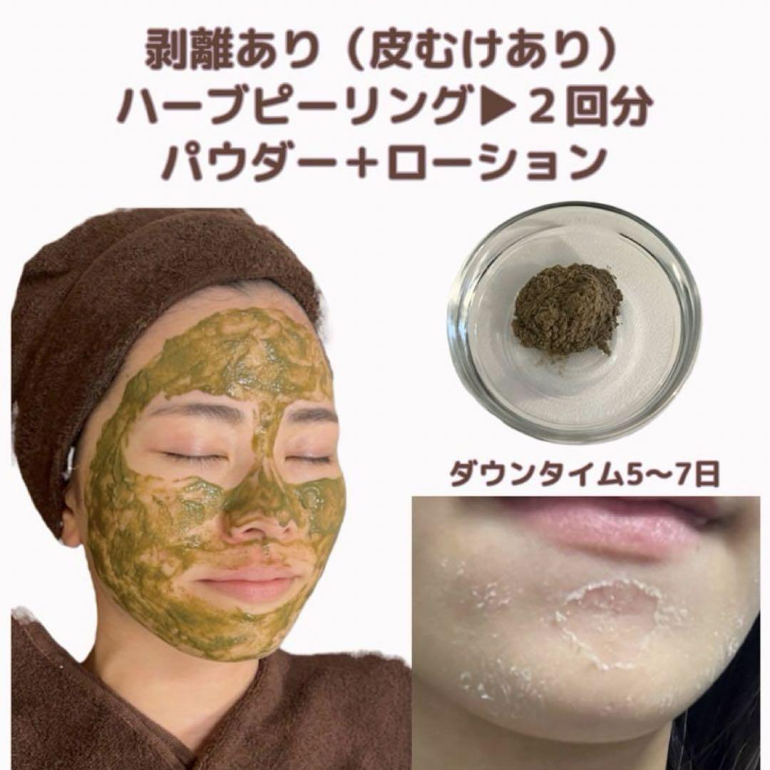 剥離ありハーブピーリング2回分
