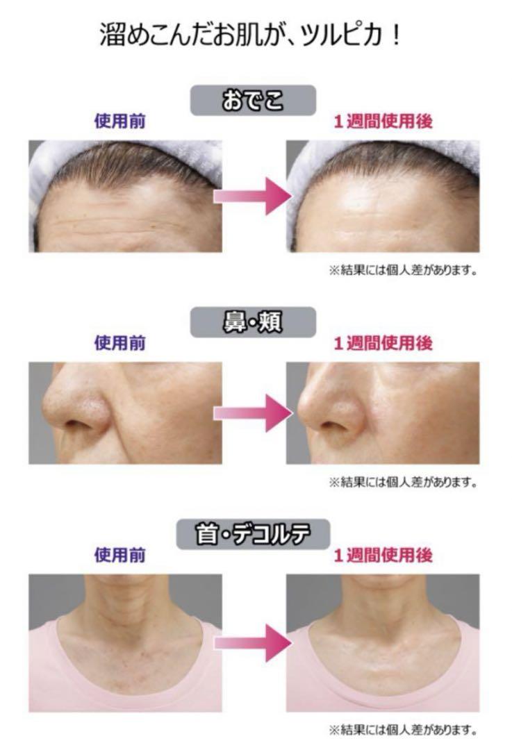リオッサ フェイス用肌磨きミトン