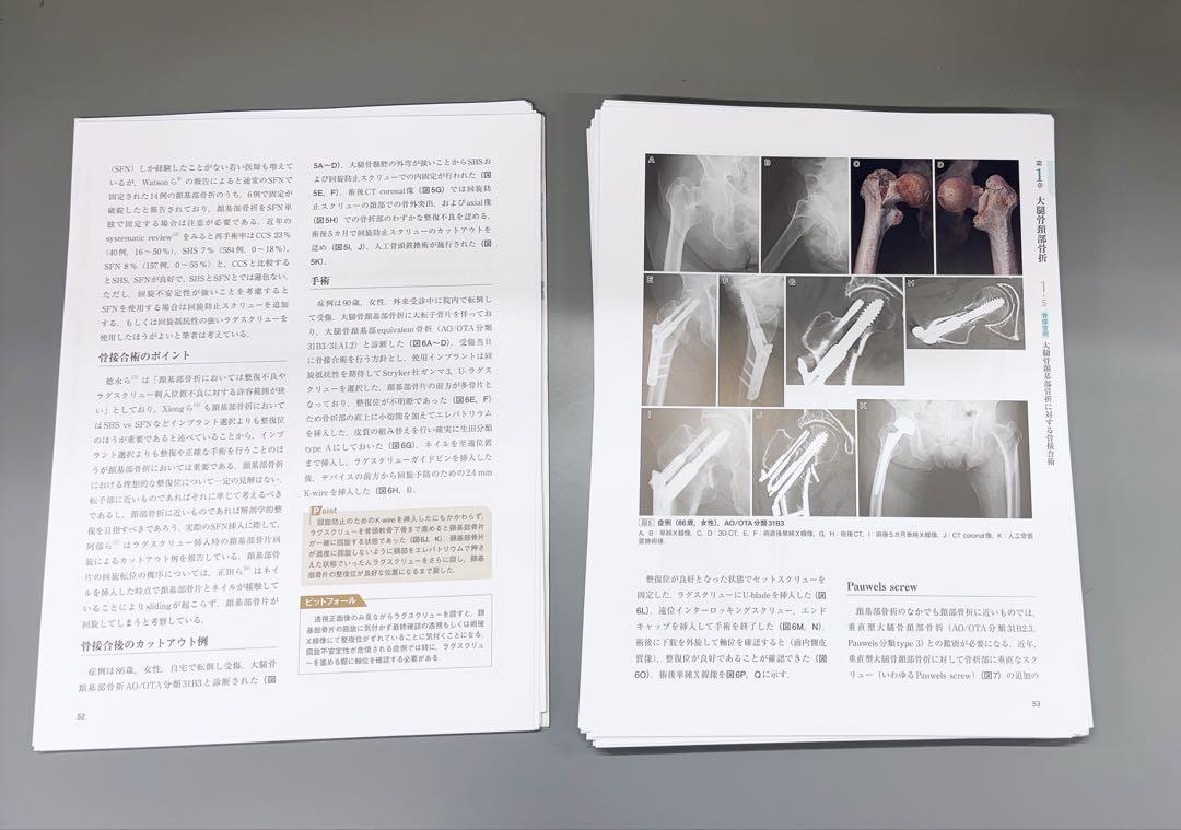整形外科サージカルテクニック12 大腿骨近位部骨折
