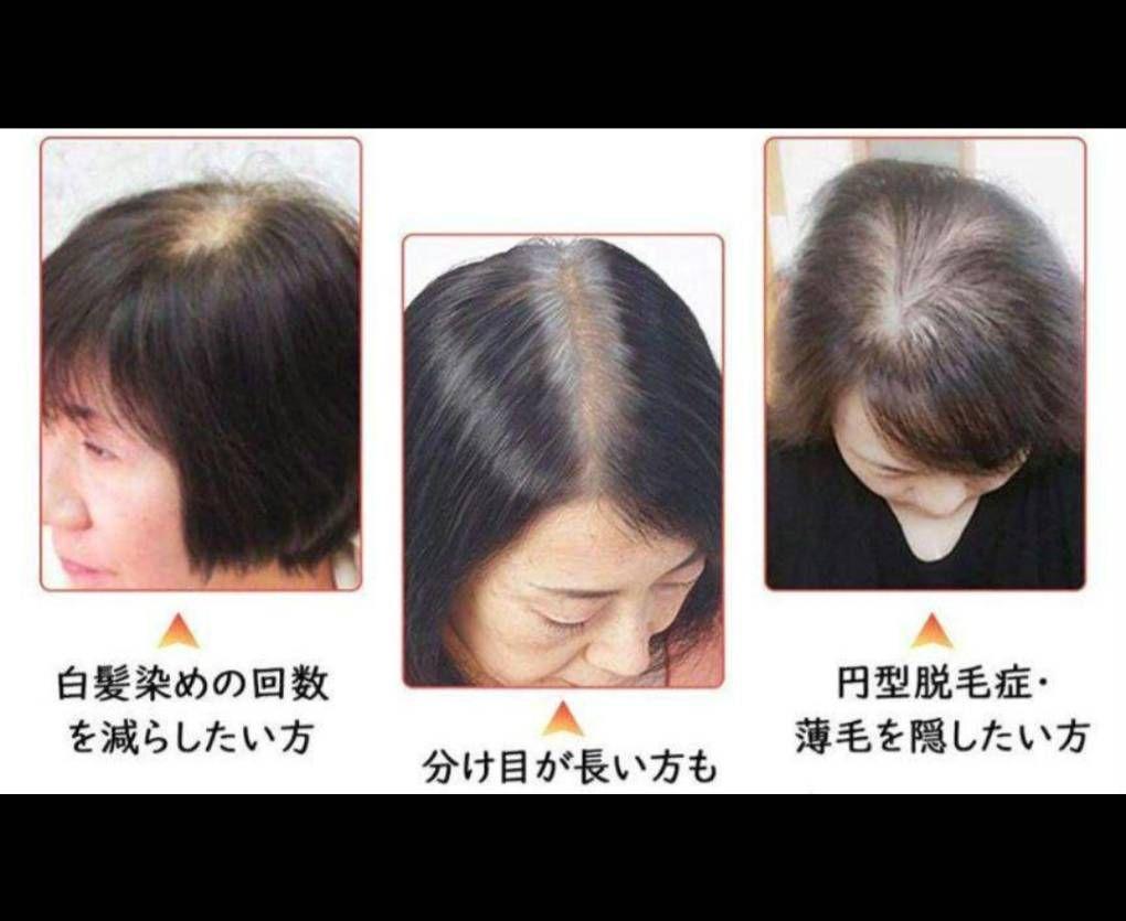 人毛100％前髪付き部分ウィッグ瞬間カバーＩ型つむじ地肌総手植えヘアピース20㎝ 人毛100％前髪付き部分ウィッグ瞬間カバーI型つむじ地肌総手植え