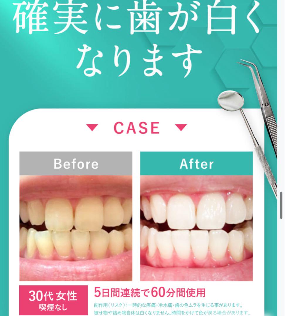 DENNOVATE TEETH WHITENING GEL PACK | DENNOVATE｜ディノベート
