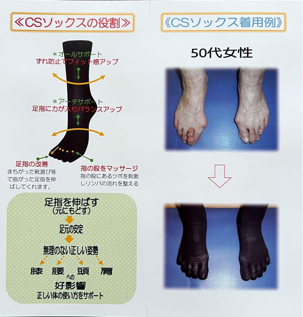 CSソックス 58 コンプレッション ダブルロング Ｓ ブラック 1足
