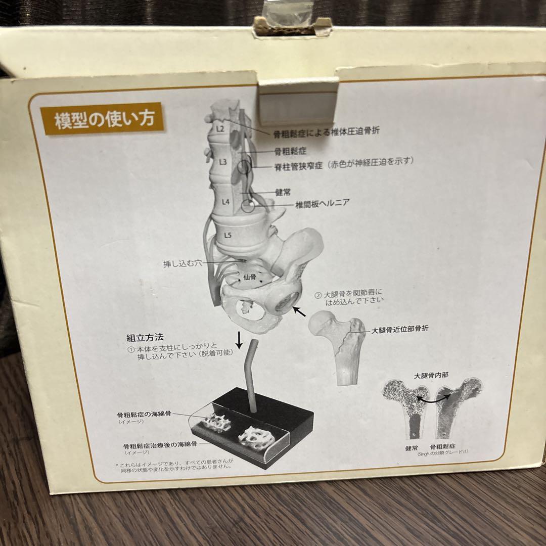 テリボン皮下注用　発売1周年記念　患者説明用　椎体・大腿骨模型