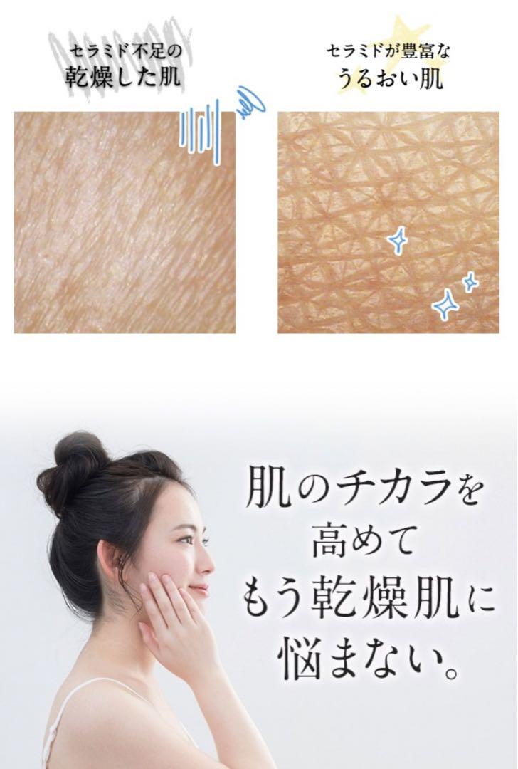 コーセー