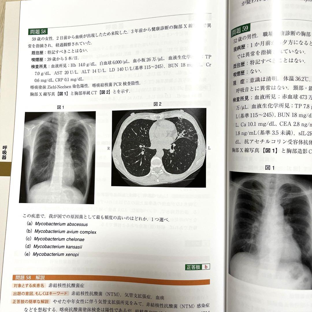 日本内科学会認定内科医試験 総合内科専門医試験 過去問題集 第2