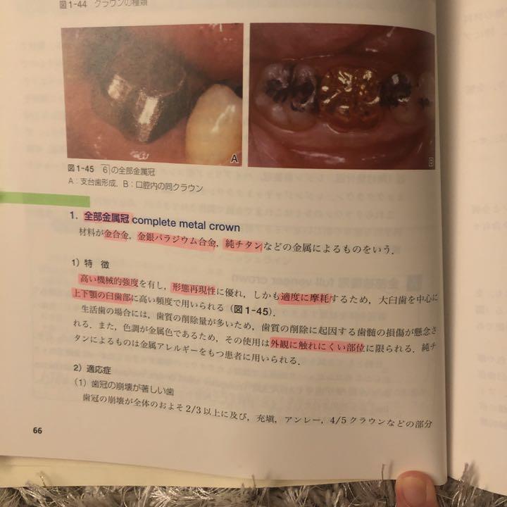 クラウンブリッジ補綴学　第5版