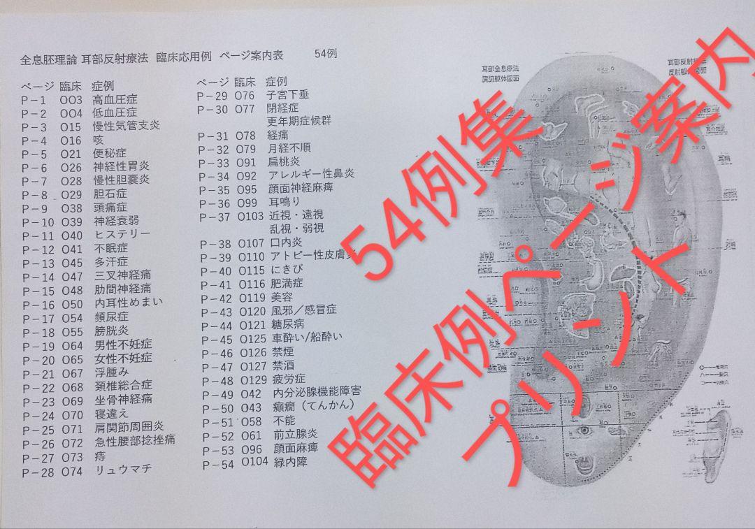 Ba耳つぼ：臨床例54例集本+臓器,躯体チャート+解説書:プロ