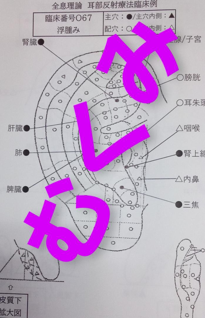 ファッション通販 Ba耳つぼ：臨床例54例集本+臓器,躯体チャート+解説書:プロ 健康・医学