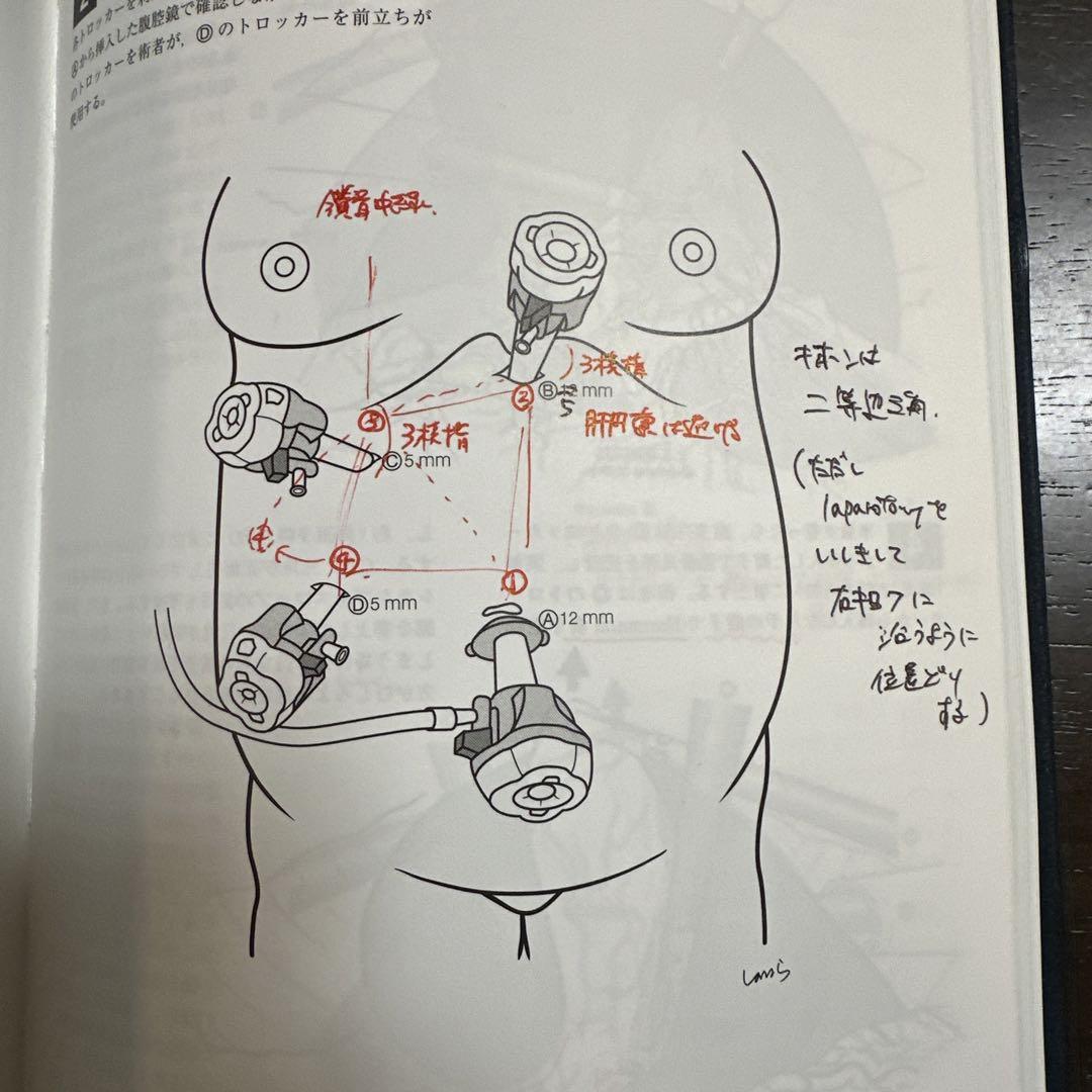 イラストレイテッド外科手術 : 膜の解剖からみた術式のポイント
