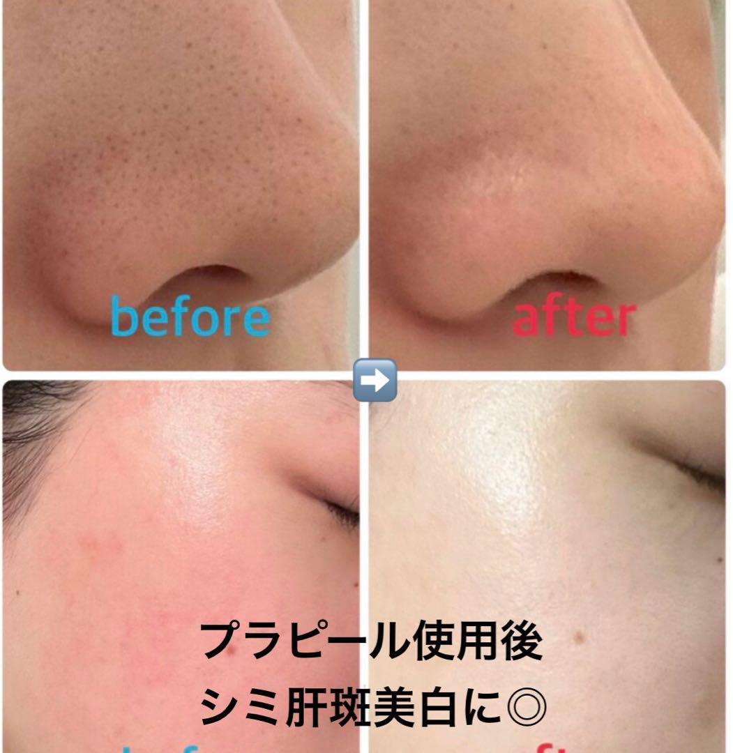 ララピールの進化版☆サロン専売プラピール2step【1set3回分