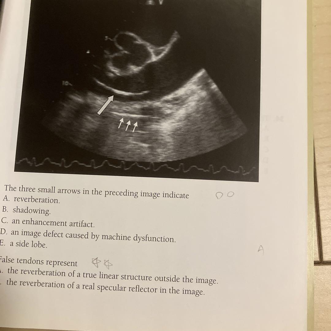 健康・医学 Perioperative Transesophageal Echocardio