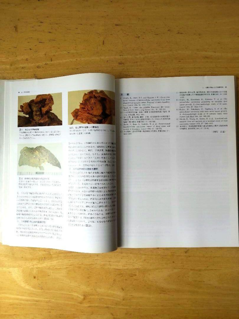 「肝臓」取扱い規約に沿った腫瘍鑑別診断アトラス