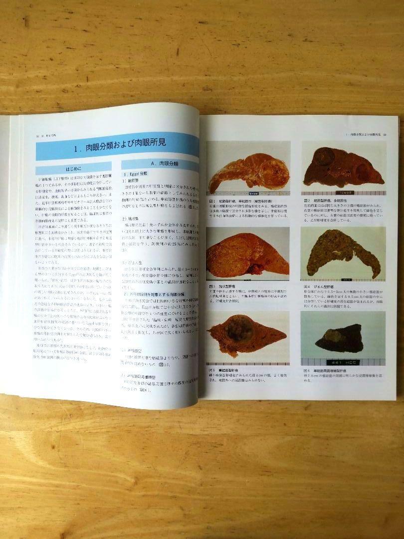 「肝臓」取扱い規約に沿った腫瘍鑑別診断アトラス