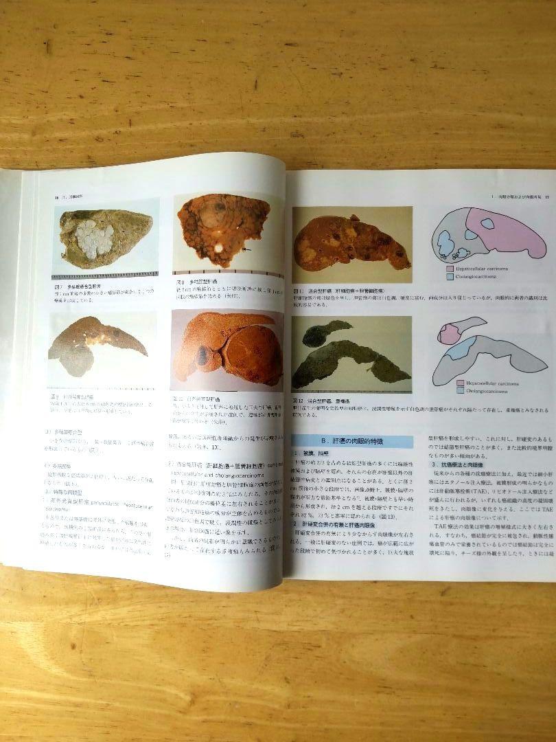 「肝臓」取扱い規約に沿った腫瘍鑑別診断アトラス