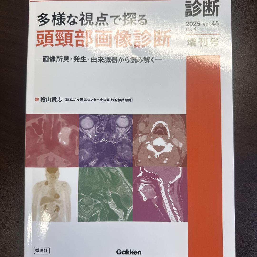 秀潤社 画像診断 2025年 増刊号 多様な視点で探る 頭頸部画像診断 画像診断2025年増刊号Vol.45 No.4 : 多様な視点で探る頭頸