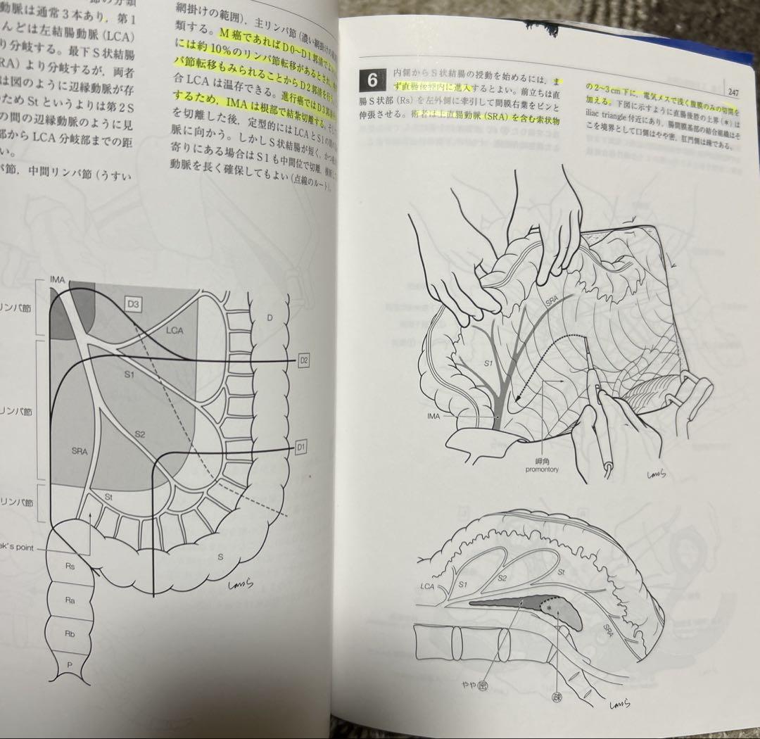 イラストレイテッド外科手術　膜の解剖からみた術式のポイント　第3版［縮刷版］