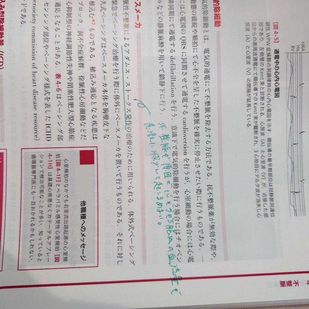 心臓リハビリテーション