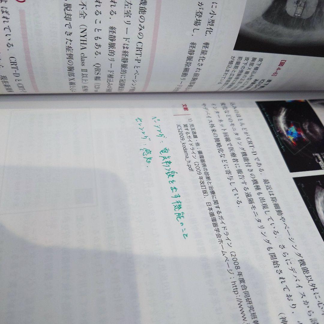 心臓リハビリテーション