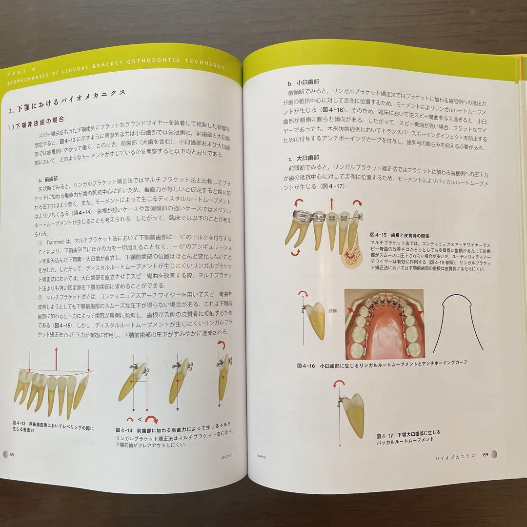 リンガルブラケット矯正法 : 審美的矯正の基礎と臨床