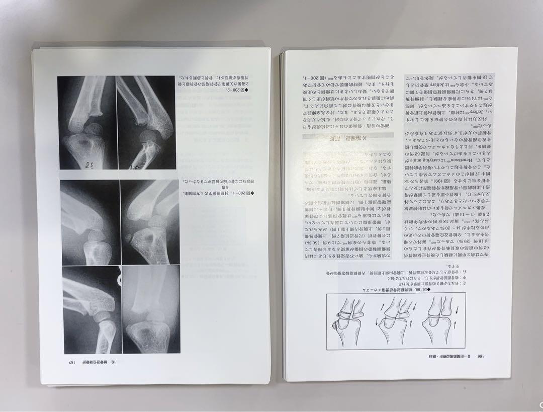小児四肢骨折治療の実際　第2版