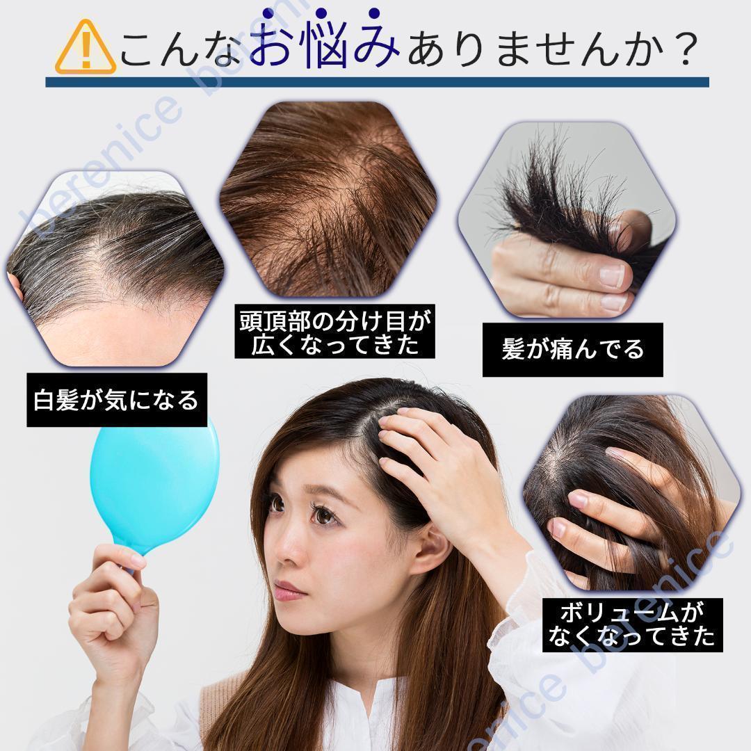 人毛ヘアピース広範囲カバー14×16つむじカバー 部分黒