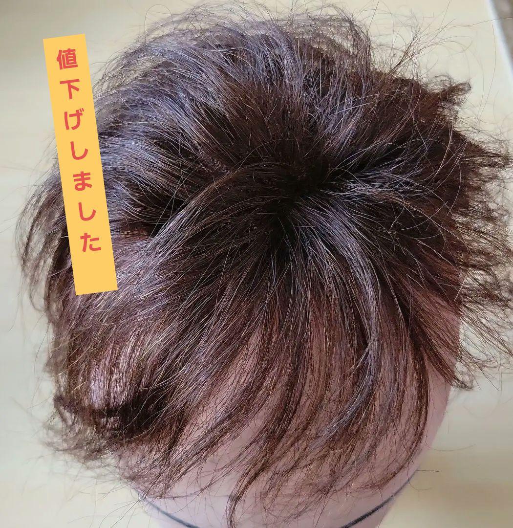 値下げ 医療用ウィッグ 人毛100% ヘアピース トップカバー