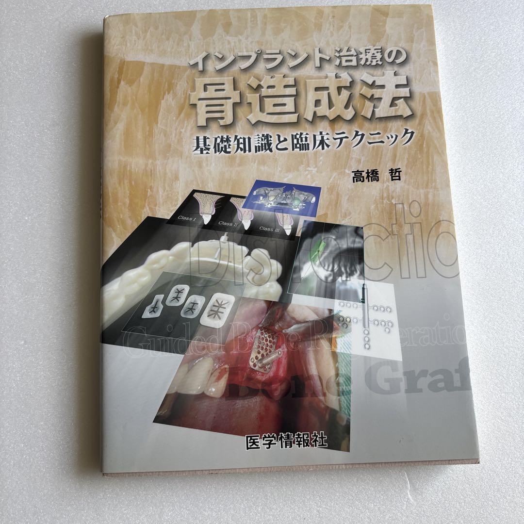 インプラント治療の骨造成法 基礎知識と臨床テクニック 即日発送!インプラント治療の骨造成法 - メルカリ