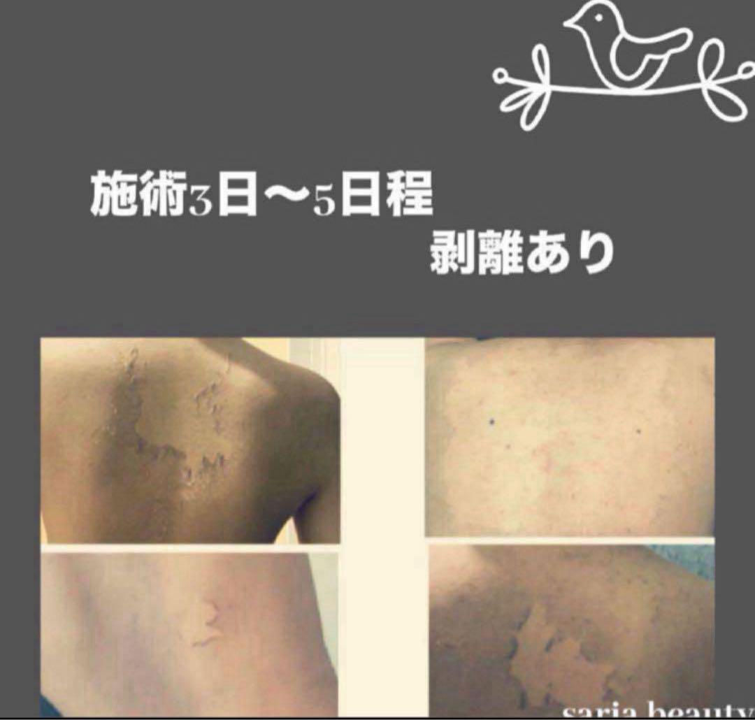 業務用 ハーブピーリング 剥離あり CICAハーブ 希少ハーブ