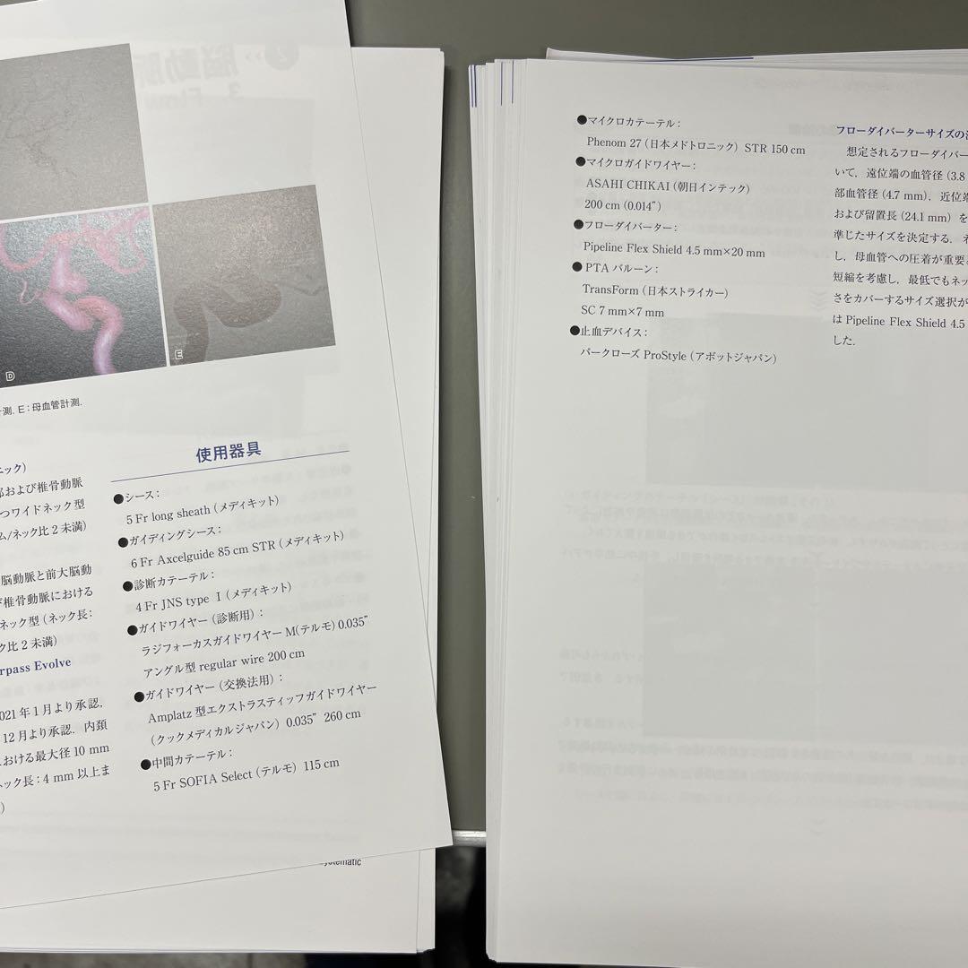 【裁断済み】脳血管内治療の基本テクニック : コマ送り解説で知識と技術が結びつく