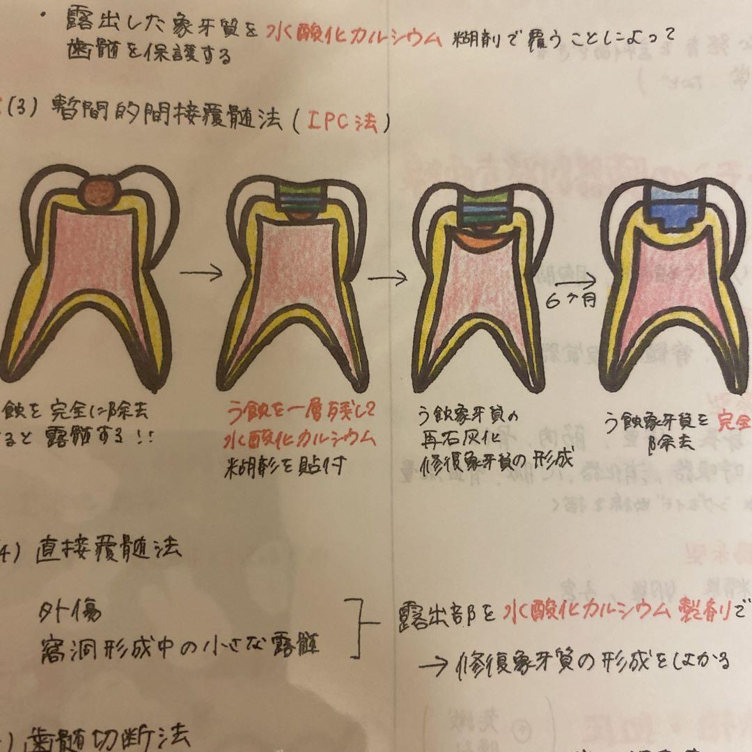 歯科衛生士国家試験まとめノート