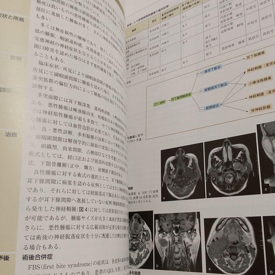 第2版 口腔咽頭の臨床 日本口腔・咽頭科学会 医学書院 0100071