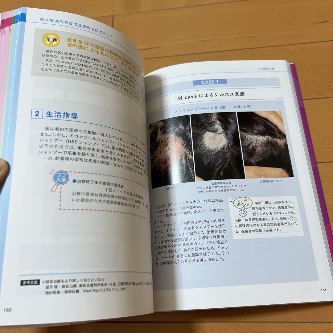 【ほぼ未使用】教えて!うたこ先生 皮膚真菌症マニュアル　皮膚科　真菌