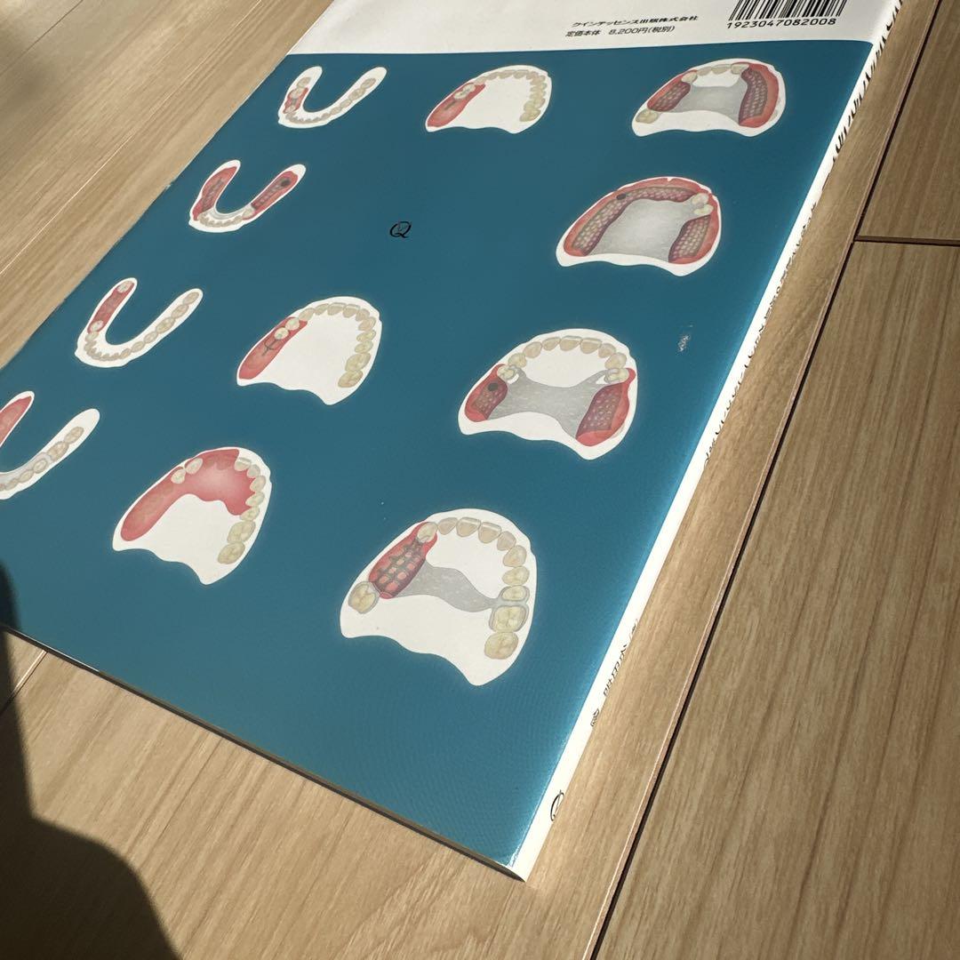 ノンメタルクラスプデンチャー　クインテッセンス出版