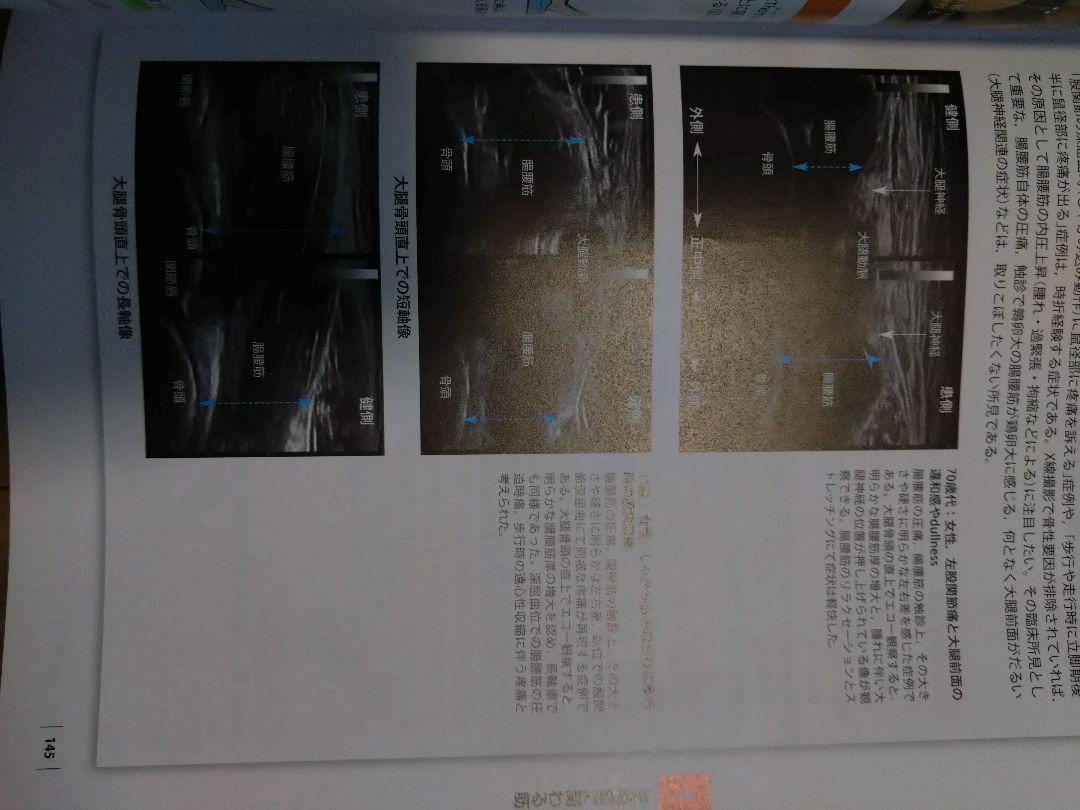 触診技術改定2版　整形外科ナビゲーション下肢　2冊セット　理学療法士　作業療法士