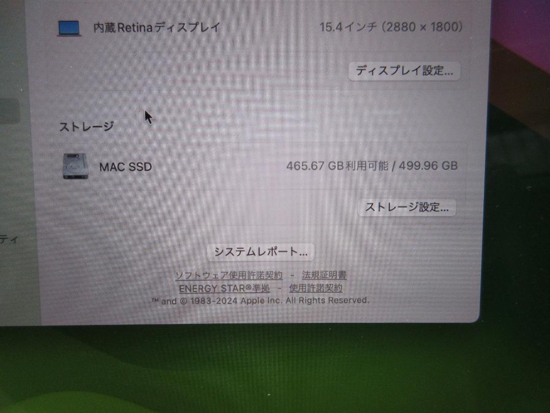 Retina