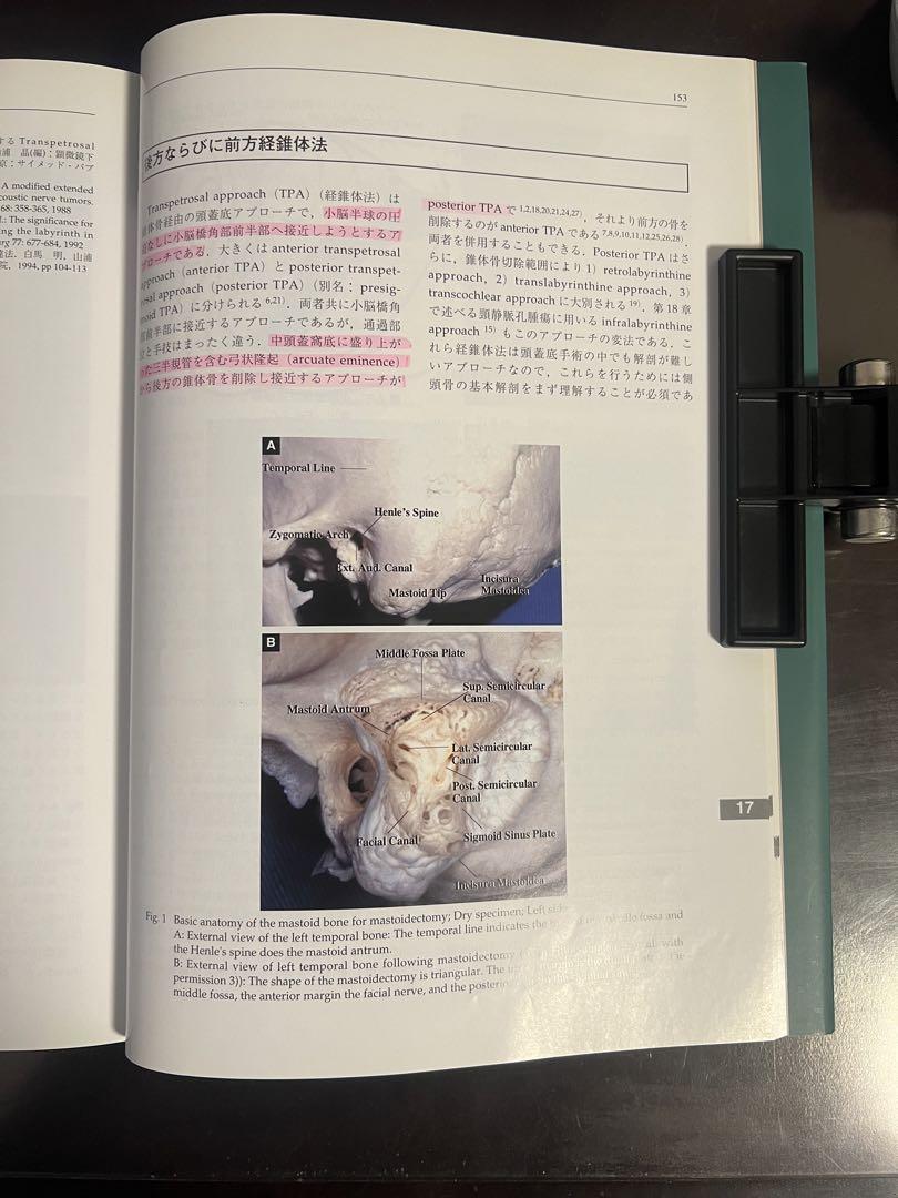後頭蓋窩の微小解剖と手術　解剖研究から実践手術へ