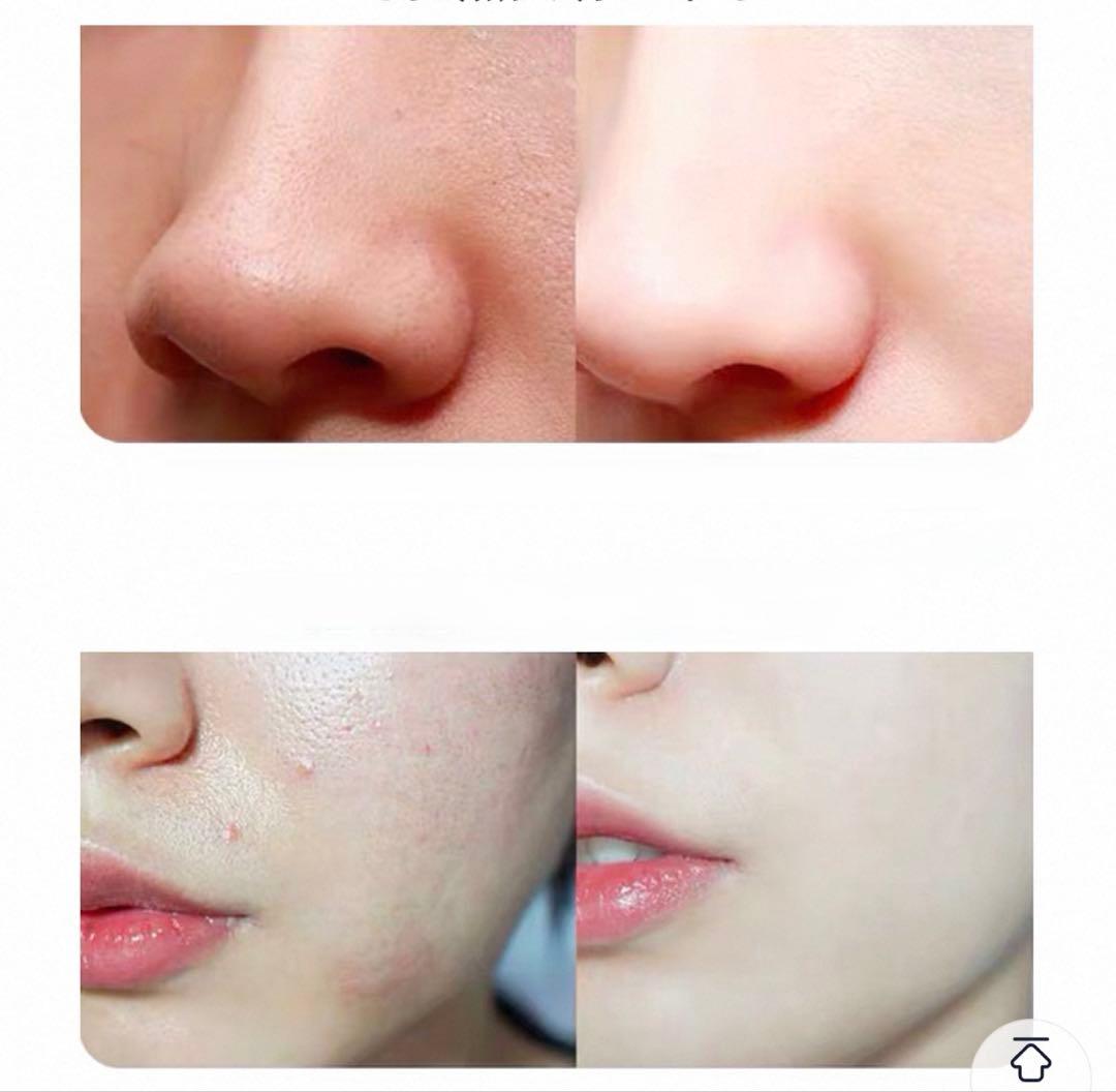 毛穴洗浄機⭐︎ エステサロン業務用 毛穴洗浄機⭐︎ エステサロン業務用