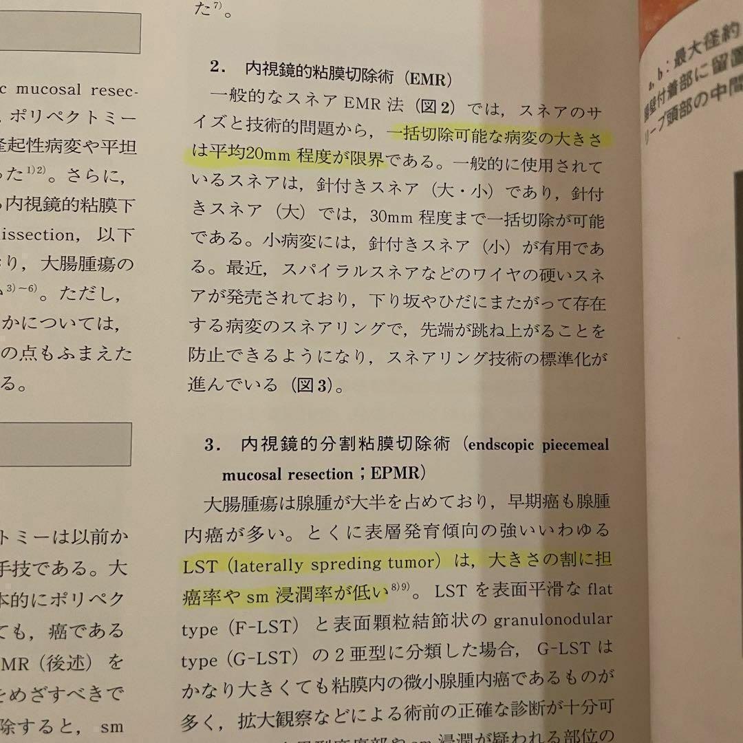 大腸癌のすべて　消化器外科　2005年4月臨時増刊号　Vol.28 No.5 大腸癌のすべて 消化器外科 2005年4月臨時増刊号 Vol.28 No.5