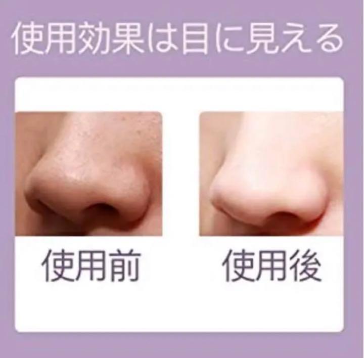 ❤エステサロンの最新温熱ケアモード搭載❣悩めるいちご鼻に最適