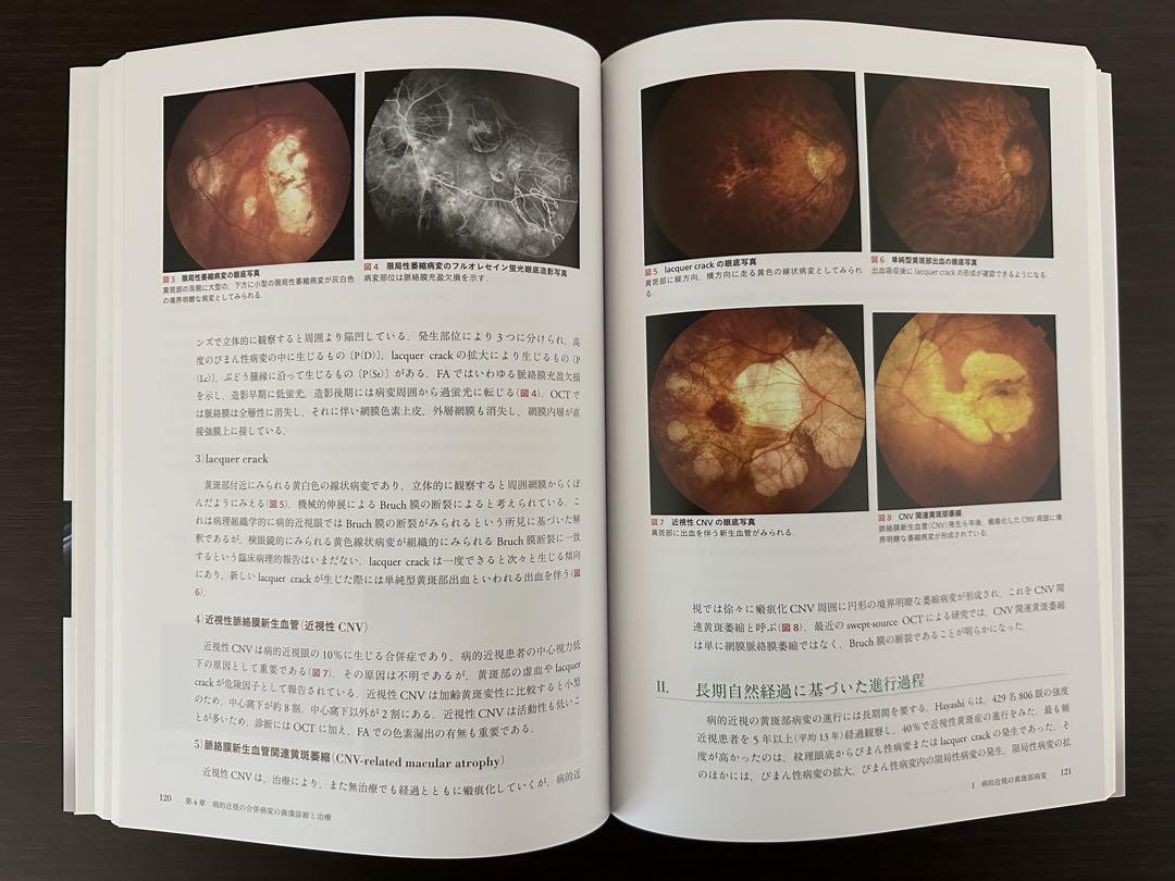 超お買い得!】 眼科臨床エキスパート 画像診断から考える病的近視診療