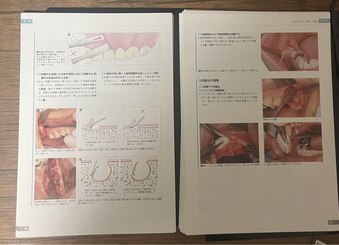 ⚠️裁断済 必ず上達 抜歯手技 増補新版