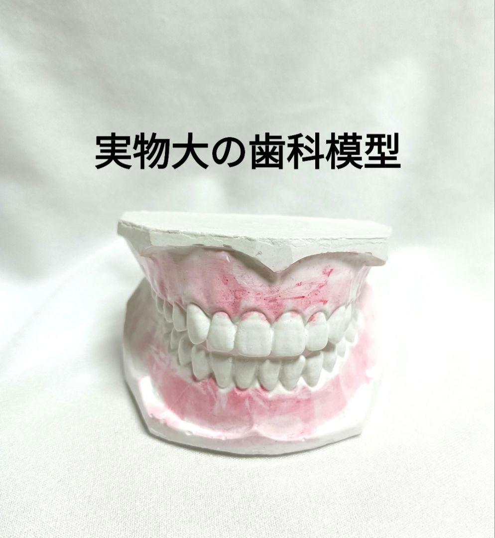 4倍大石膏製模型歯 4倍大石こう製模型歯 [C4-304]｜株式会社ニッシン｜歯科模型