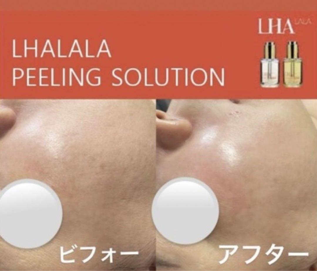 人気ブランド 海外通販 - 国内入手困難 即日発送】LHALAララピール・洗顔 2回分 刷毛1本プレゼント 美容液