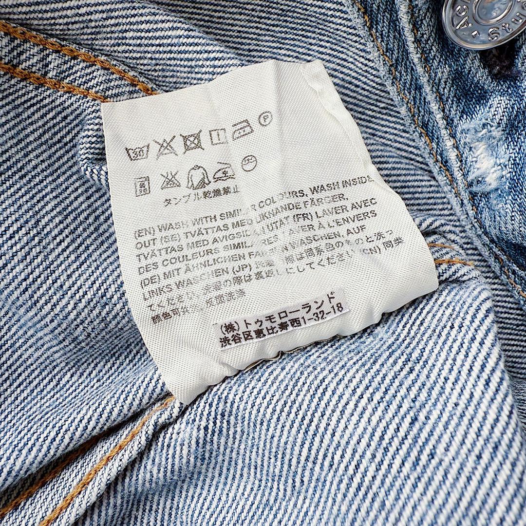 Acne